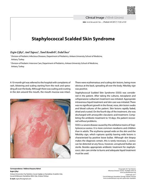 Pdf Staphylococcal Scalded Skin Syndrome