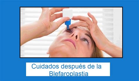 Cuánto duran los efectos de la blefaroplastia Clínica Navarro Viana