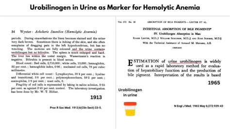 Urobilinogen in Hemolytic Anemia • The Blood Project