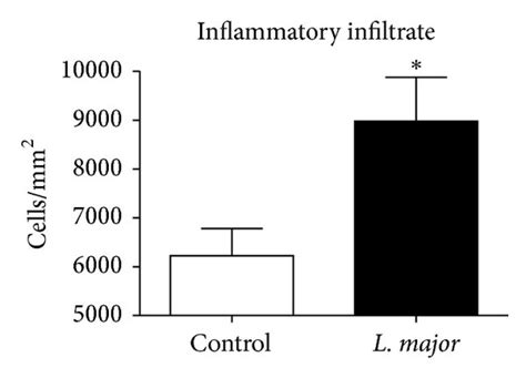 Atherosclerotic Lesions And Inflammatory Infiltrate In Apoe Ko Mice