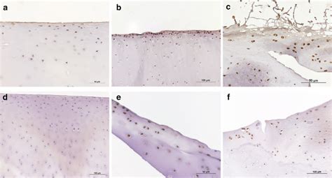 Photomicrographs Of Cartilage Immunostained For Opioid Receptors Mor