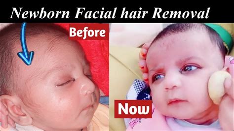 How To Remove Baby S Body Hair Permanently Remove Baby Hair On