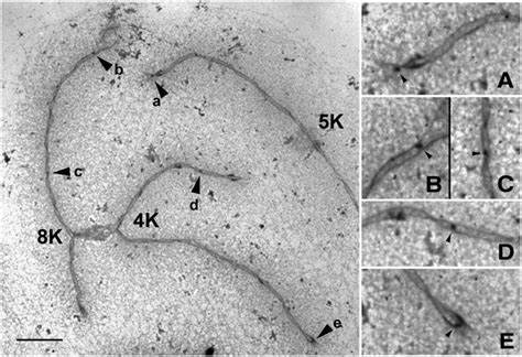 Electron Micrograph Showing Late Nodules On Scs Download Scientific