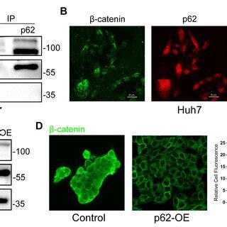 p62 interacts with β catenin and down regulates the expression of