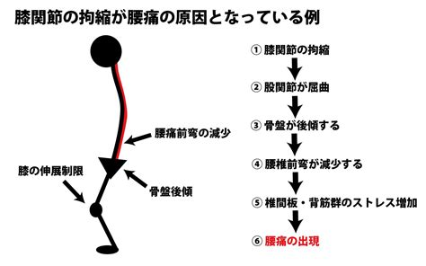 非特異的腰痛症について正しく理解する