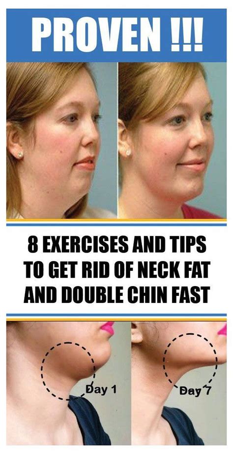 Face Exercises Double Chin Removal At Frieda Leach Blog