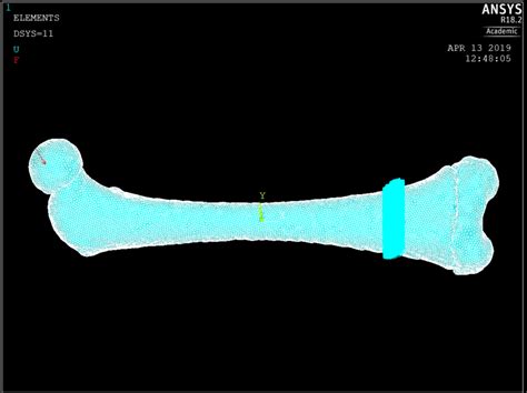 High Distortion In Nonlinear Analysis Of Hyperelastic Material Mapdl