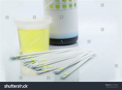 Reagent Strip Urinalysis Routine Urinalysis Checkup Stock Photo