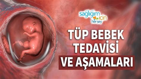 Tüp Bebek Tedavisi ve Aşamaları YouTube