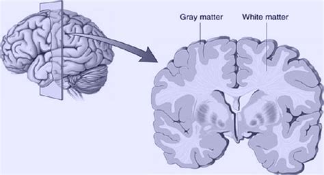 How To Increase Gray Matters In The Brain Inner Light Publishers