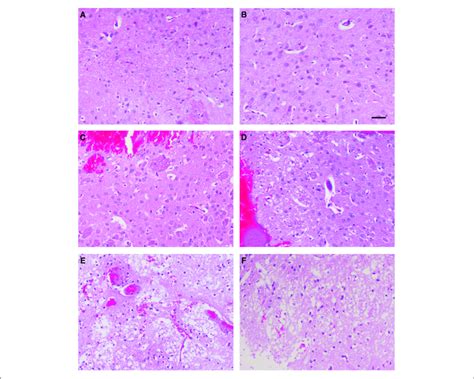 Histopathological Examination Of Mouse Brain Tissues H After