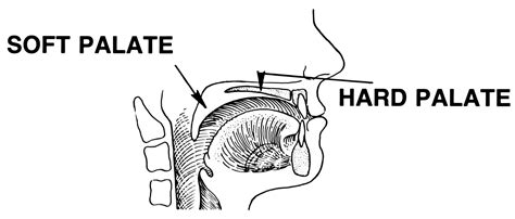 Palato Anatomia Concise Medical Knowledge