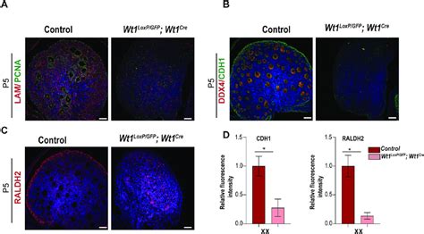 Deletion Of Wt1 During Early Gonadogenesis Has A Great Impact On