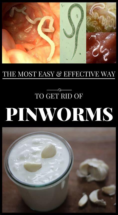 The Most Easy And Effective Way To Get Rid Of Pinworms