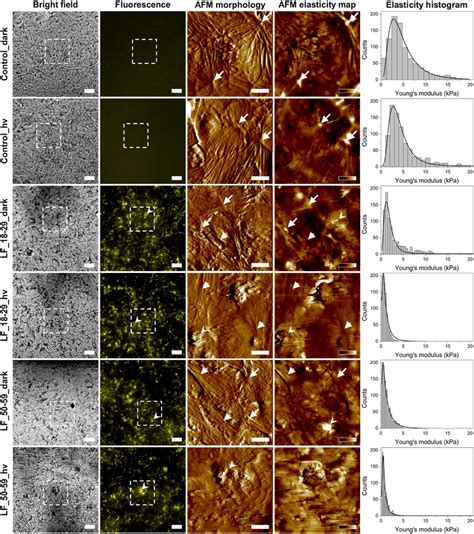 Elasticity Analysis Of Arpe Cells With Phagocytized Lipofuscin