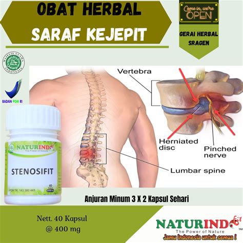 Jual Obat Herbal Saraf Kejepit Pinggang Nyeri Otot Encok Sakit Pinggang