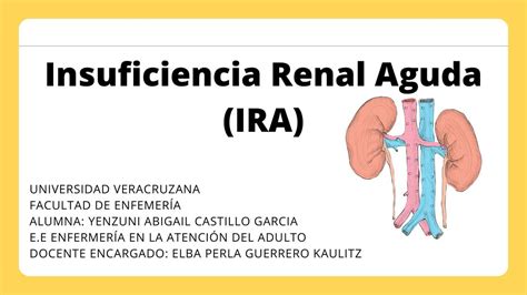 Insuficiencia Renal Aguda Yenzuni Abigail Castillo Garcia UDocz