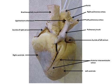 Label The Sheep Heart