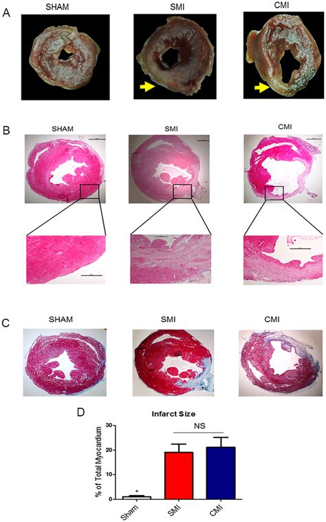 Short Term And Long Term Infarct Sizes In The Two Mi Models A