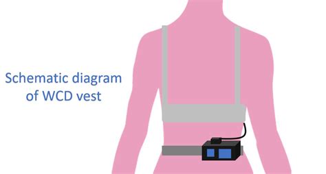 How Good Is A Wearable Cardioverter Defibrillator All About