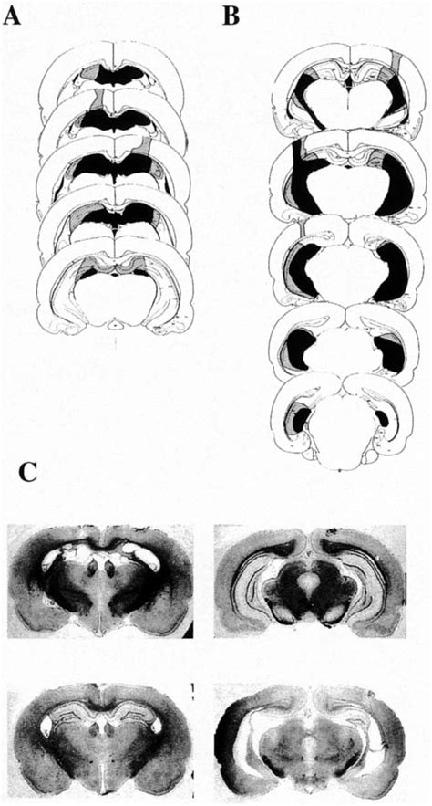 Figure 1 From Both Dorsal And Ventral Hippocampus Contribute To Spatial