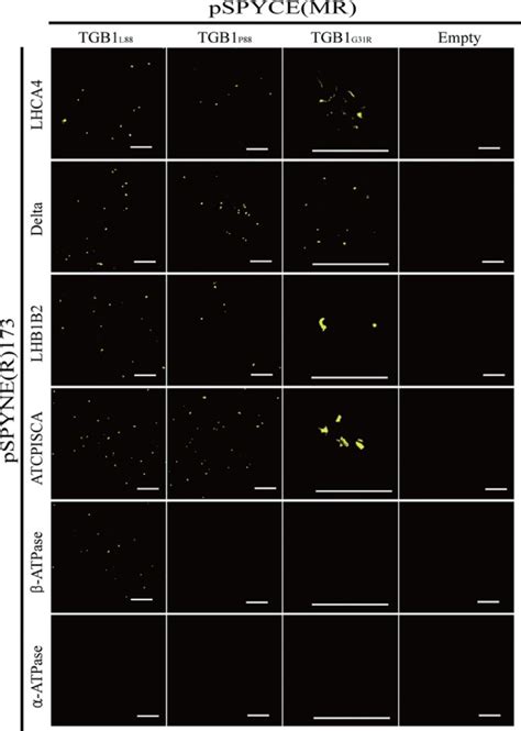 Bimolecular Fluorescence Complementation Assay Resulting From