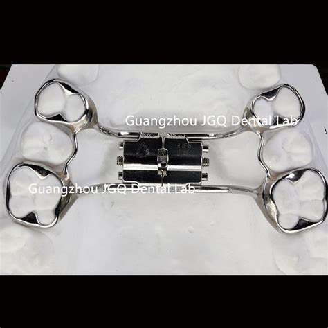 Dental Orthodontic Suppliers OEM Stainless Steel Expansion Screw