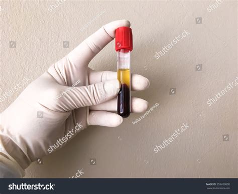 Hand Holding Test Tube Blood Plasma Stock Photo 559429000 Shutterstock