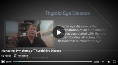 TED Community Organization | Thyroid Eye Disease Solutions Organization