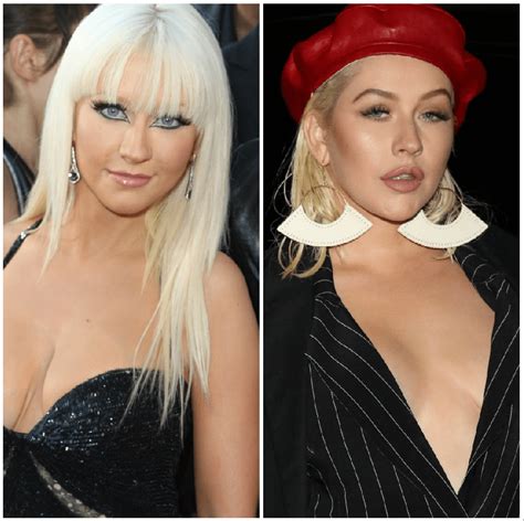 Christina Aguilera Plastic Surgery — Experts Weigh In On Transformation