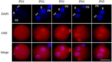 Localization Of Gse In Fertilized Mouse Oocytes The Dynamic Appearance