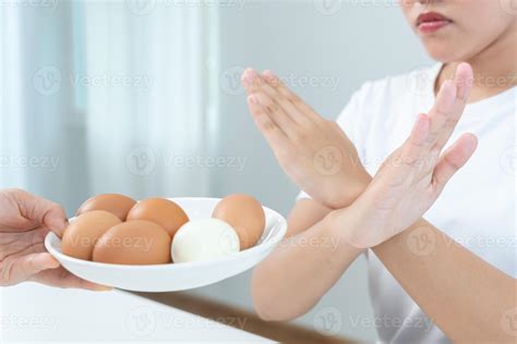 ovalbumin allergy, women refuse eggs, swollen mouth, swollen eyes