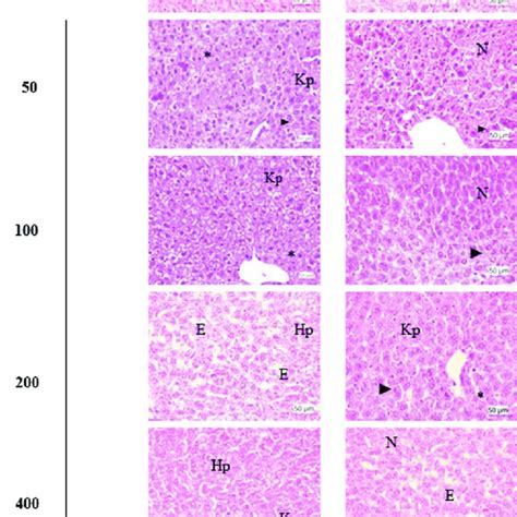 Histological Sections Of The Liver From Female A And Male B Balb C