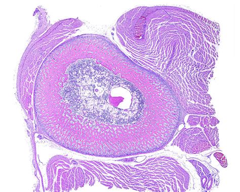 Ossification Immature Bone Photograph By Jose Luis Calvo Fine Art