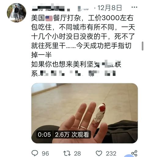 李阿东 On Twitter 这位润人从移民监出来的时候戴了个电子脚链，要定时去报到，半个多月过去了，发现戴着这玩意儿真的很不方便 顺便说一下，这哥们儿属于那种一直很清醒的润人，也没有