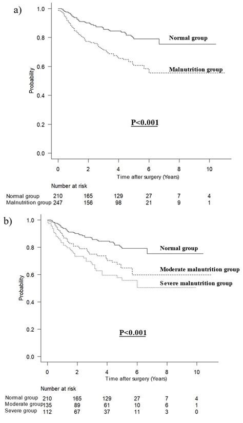 Jcm Free Full Text Association Of Glim Defined Malnutrition