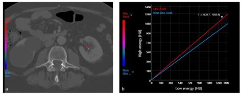 Applied Sciences Free Full Text Dual Energy Ct Applications In