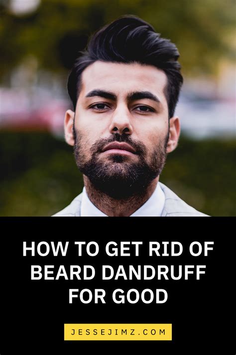 How To Get Rid Of Beard Dandruff For Good Beard Dandruff Dandruff