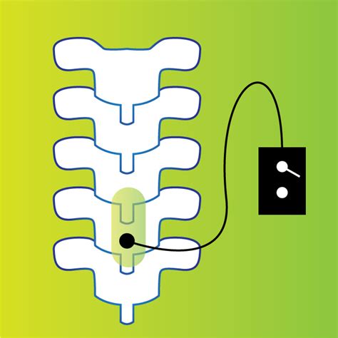 Effects Of Non Invasive Spinal Cord Stimulation On Bladder Bowel And Sexual Function In People