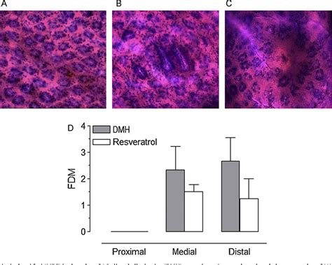 Figure 1 From Colorectal Cancer Chemoprevention By Trans Resveratrol