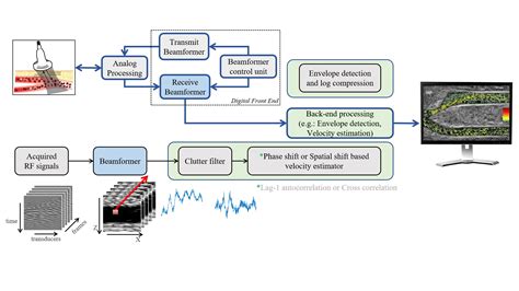 Ultrafast Ultrasound Based Flow Imaging Pulse Echo