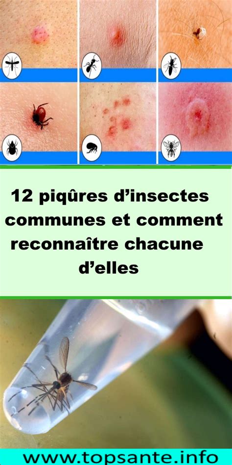 12 piqûres dinsectes communes et comment reconnaître chacune delles