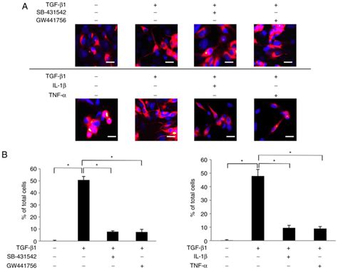 Il‑1β And Tnf‑α Suppress Tgf‑β‑promoted Ngf Expression In Periodontal