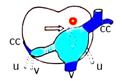 Sinus Venosus Embryology | Heart