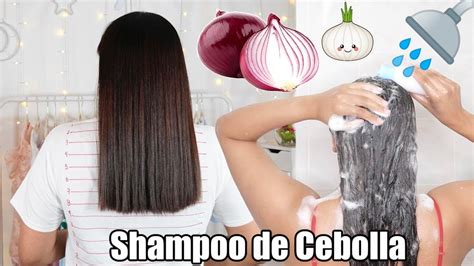 Shampoo De Cebolla Para El Crecimiento Extremo Del Cabello En Dias