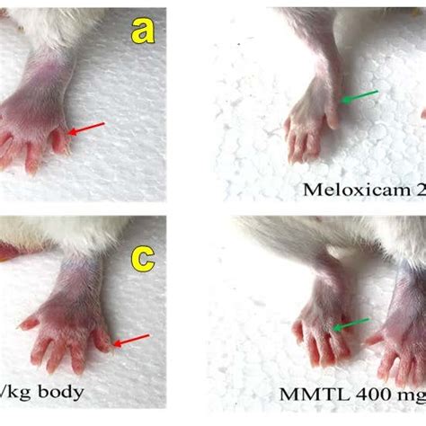 Effect Of Mmtl On Changes In Paw Edema Volume In Carrageenan Induced