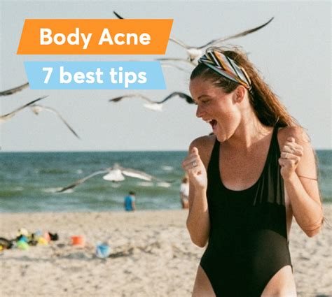 7 Best Ways To Prevent And Treat Body Acne Mdacne