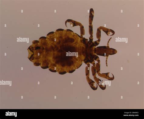 Pork louse as a parasite under the microscope 50x Stock Photo - Alamy