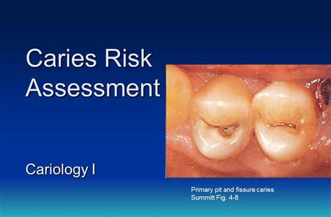 Dentistry Caries Risk Assessment