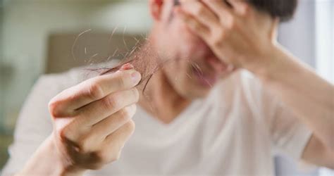 Rambut Rontok Pada Pria Penyebab Dan Cara Mengatasinya